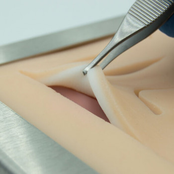 skin pad